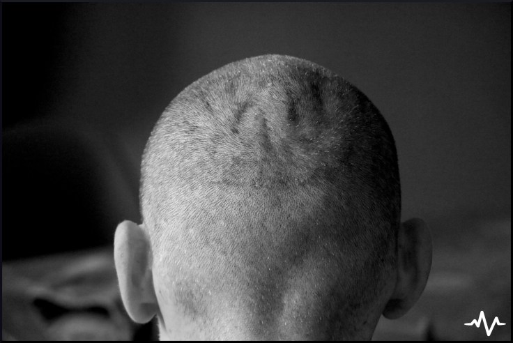 17.08.27_Nuque_copyright